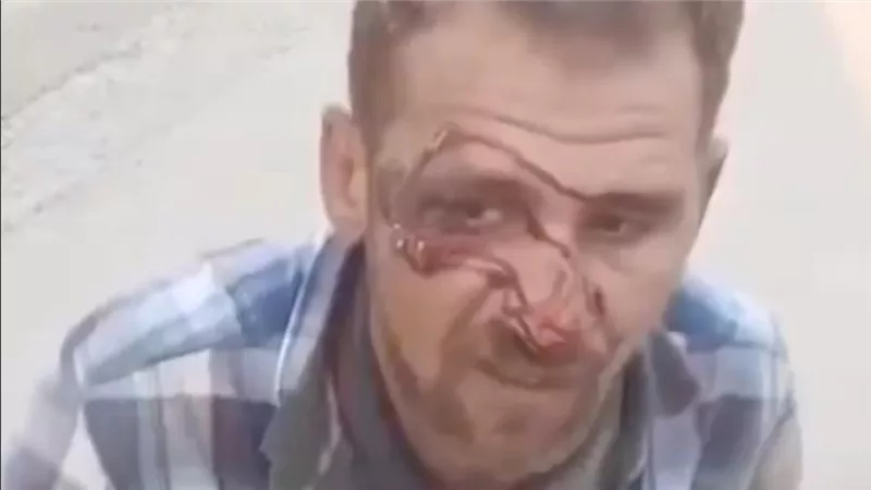 بسبب لمس مرآة سيارتها.. اتهامات لسيدة خليجية بدهس عامل دليفري في التجمع الخامس 