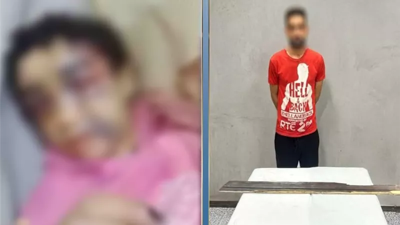ضبط أب بالإسكندرية اعتدى على ابنته 12 عامًا وأصابها بكسور وكدمات متعددة