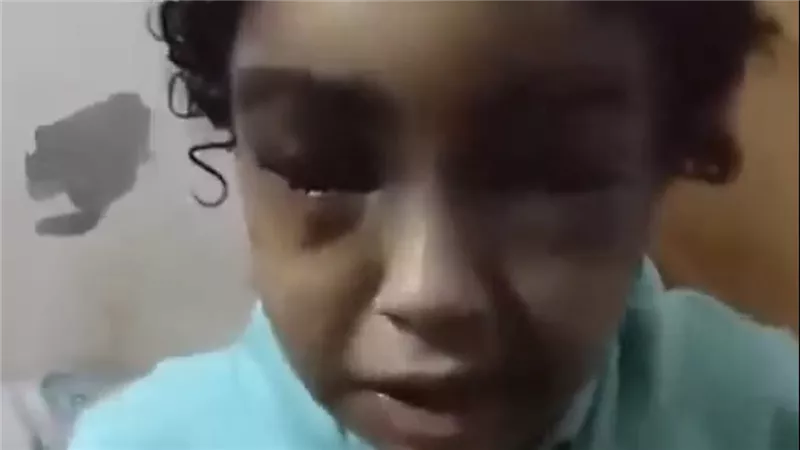 «ساعديني يا طنط نسمة والنبي».. صرخة طفلة تكشف مأساة تعذيبها على يد والدها بالإسكندرية