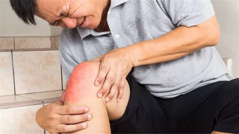 ودعي الانتفاخ سريعا.. عادات يومية تُخفف من تورم الجلد بعد حوادث التصادم