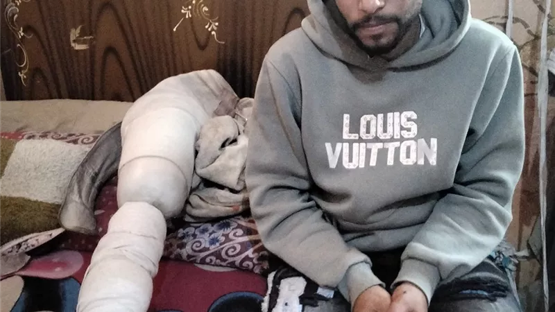 فقد قدمه في حادث.. عمر يناشد الرئيس السيسي: أخويا مريض ونفسي أجيب توكتوك