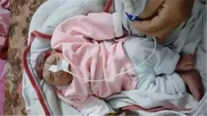 ارتفاع الإجهاض وتشوهات الأجنة في غزة واتهامات باستخدام أسلحة محرّمة