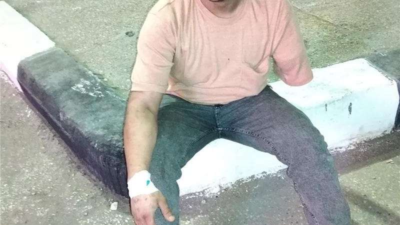 وعكة صحية جديدة تضرب محمد البسطويسي ضحية سيرك طنطا بعد أيام من عقد قرانه