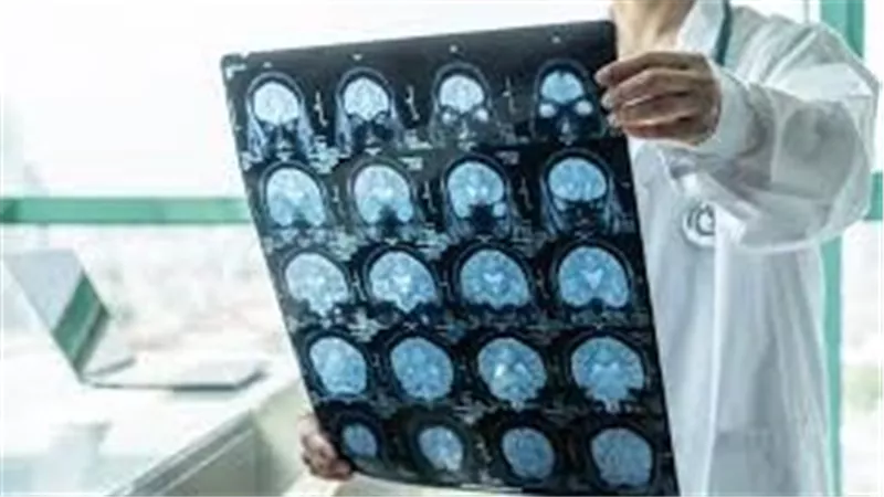 دراسة طبية .. الرنين المغناطيسي ينذر بالسكتة القلبية