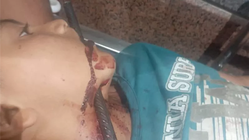 5 ساعات بغرفة العمليات.. مستشفى سوهاج تنقذ حياة طفل بعد اختراق سيخ رقبته